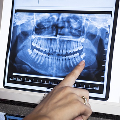 Panoramic dental x-rays