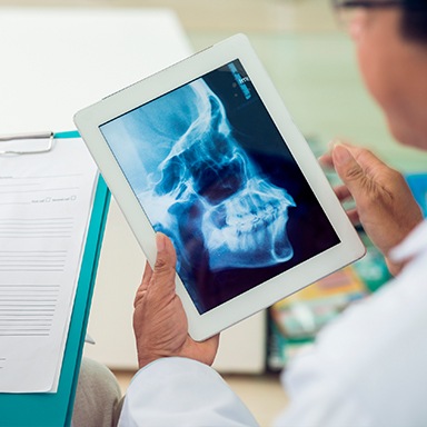 Jaw and skull bone x-rays