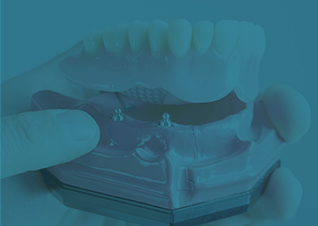 Model implant supported denture