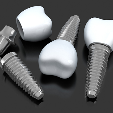 Animation of implant supported dental crowns