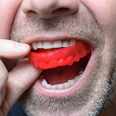 Man placing sports mouthguard