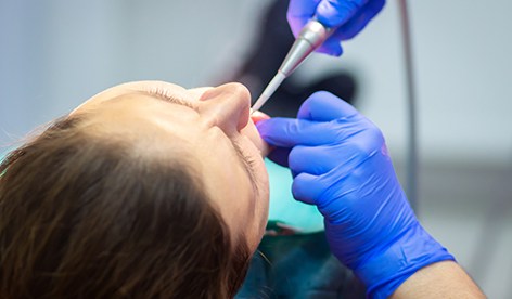 woman wearing nitrous oxide mask