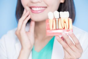 Dentist holding model jaw with dental implants in Marble Falls